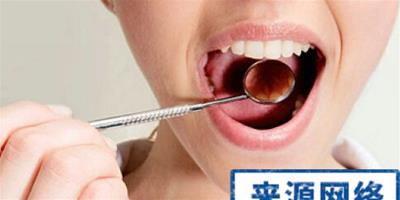 洗牙常見的四個誤區